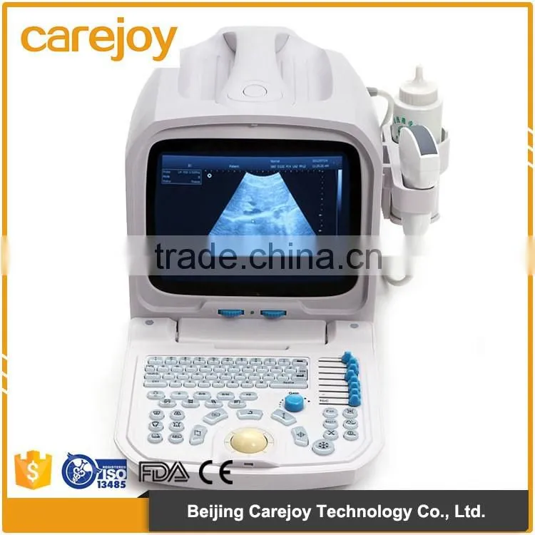 Medical hospital ultrasound diagnostic machine portable ultrasound equipment