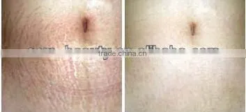 hot selling products wrinkle removal acne removal microneedling pen EL011