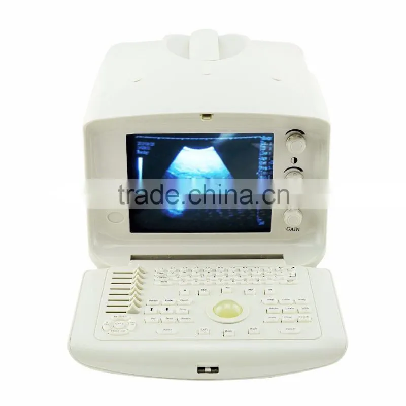 CE ISO approved One-stop shopping service pc based ultrasound scanner portable laptop