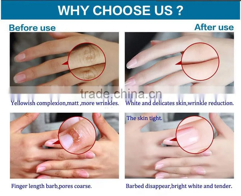 Soft repair desalt splash whitening soothe cracks hand peeling mask Rose whitening peeling moisture hand mask