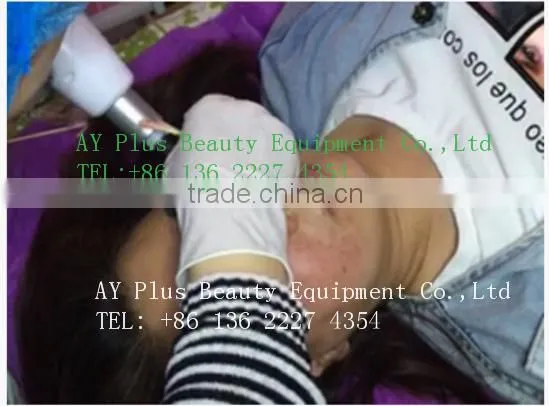 AYJ-SC101 ayplus mesotherapy injection gun