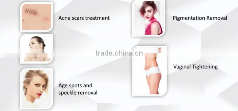 US RF pipe 40W co2 laser acne scar removal and laser skin laser resurfacing machine