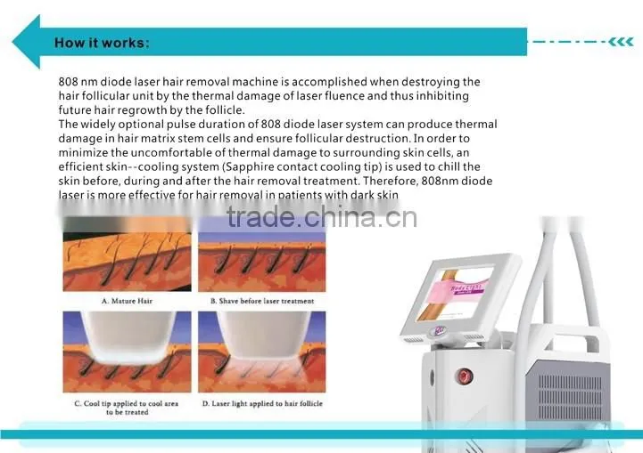 China factory 808nm diode laser permanent hair removal skin care machine for sale---DIDO-IV