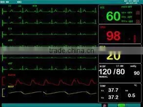 F5 Multi-parameter Monitor