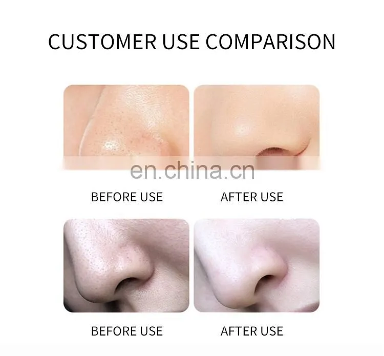 10 IN 1 Comprehensive Facial Massager Beauty Instrument Ion Bubble Cleansing Oxygen Hydration Rejuvenation Skin Care Machine