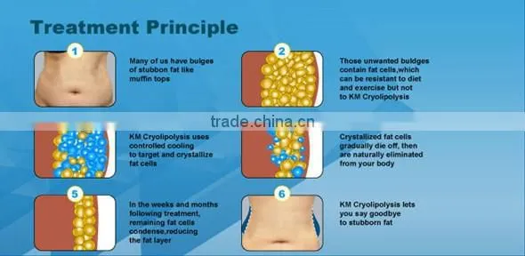 RF cavitation vertical fat freezing cryotherapy device