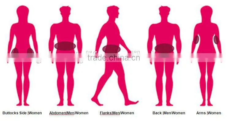 2016 best beauty machine cryolipolysis machine
