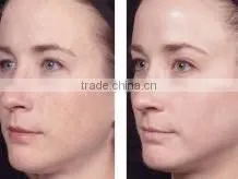 M-L02 most popular LED Light Treatment Facial Skin Care Red Green Blue Light for skin rejuvenation