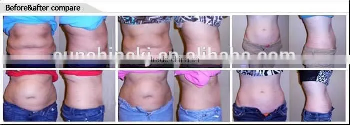 laser weight lose machine/body shaping machine/fat remover