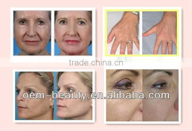 CEapproval! multifunctional derma roller for skin care EL011
