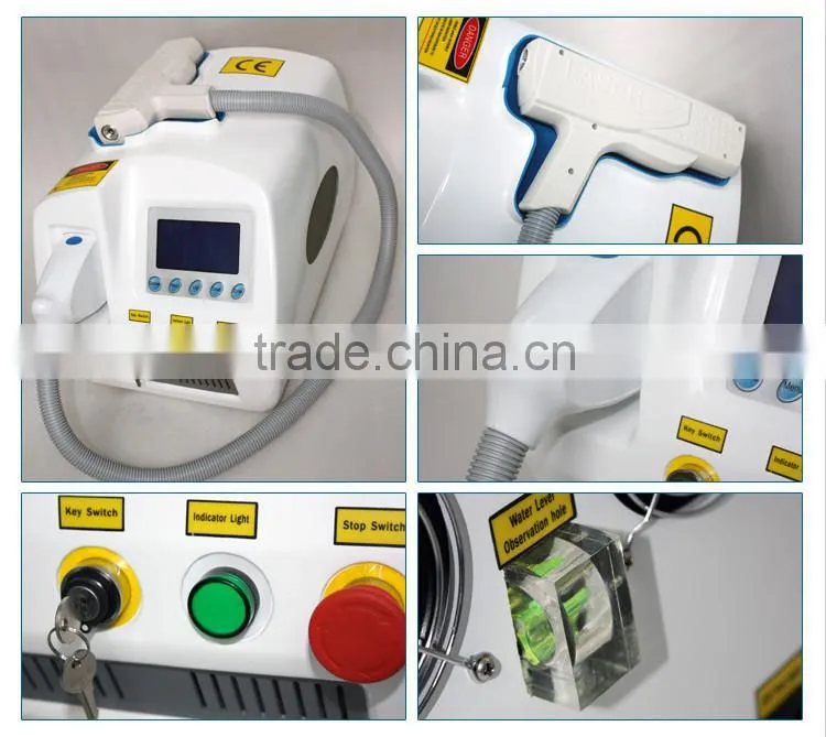 2016 latest laser softlight nd yag laser 1064 nm wavelength tattoo removal machine