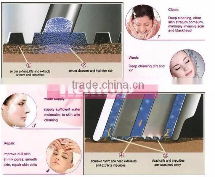 2 in1 Mini Diamond Microdermabrason machine Peeling Dermabrasion Skin Care Spa Device Peeling Device Clean Pore