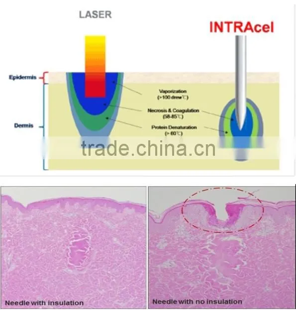 Face lifting machine fractional RF microneedle facial machine aesthetic equipment