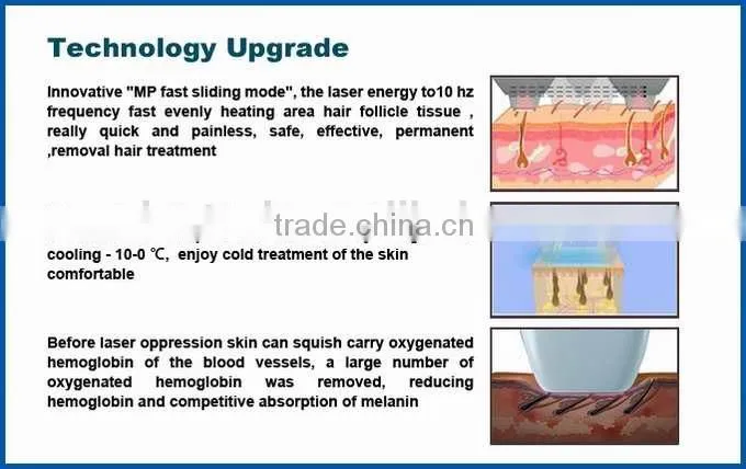 New products 2016 Permanent Ipl +808 nm diode laser hair removal machine/laser hair removal germany