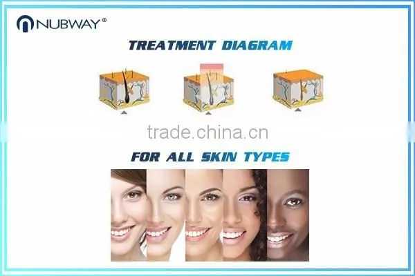 low price depitime hair removal with 808nm diode laser hair removal machine