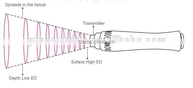Non-invasive fat removal shockwave / acoustic wave / Technology