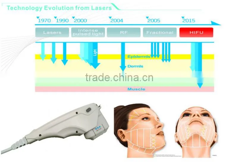salon equipment supply F2 hifu for skin tightening