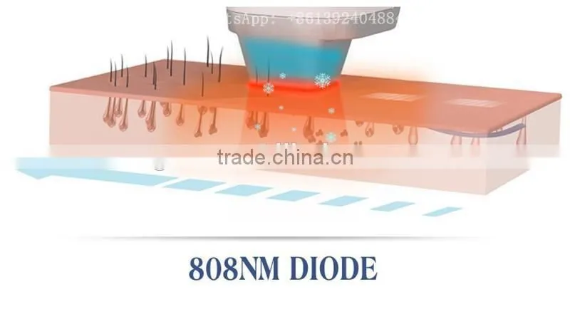cheap portable 808nm laser diode/808nm/laser hair removal machine