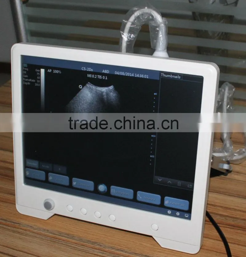 Full Digital Medical Ultrasound Scanner With Ce Marked