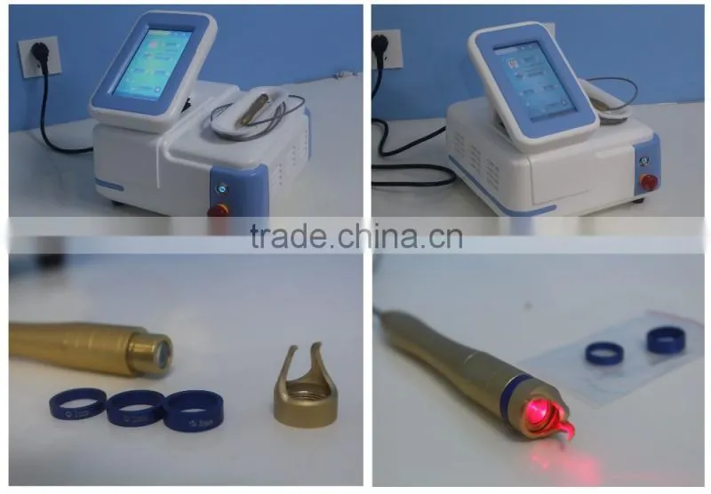 Effective pigment removal CE approval diode laser for spider vein removal