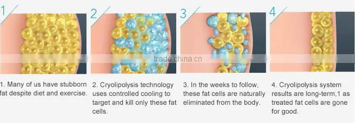 Cool sculpture machine criolipolise cold zero cryo lipo laser machine SL-2