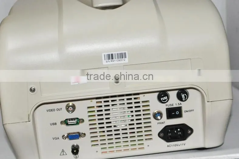 2016 CE Approved Digital Portable Style Ultrasound Machine/Scanner with cheap price