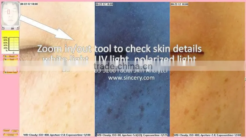 Wood Lamp Scanner Machine For Facial Skin Analysis