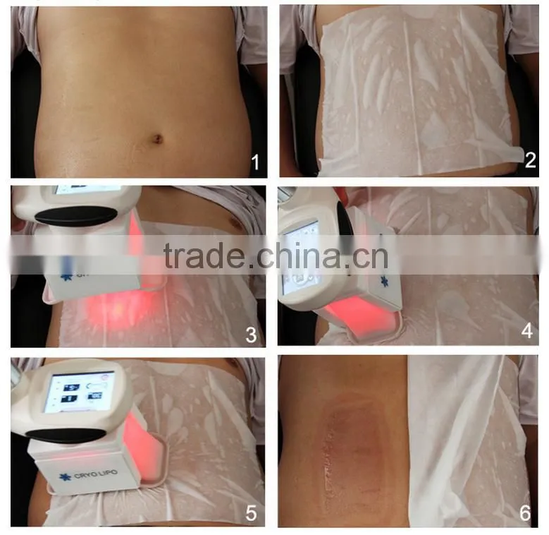 High Quality!! Two Cool Handles Working at Same Time Fat Freeze Machine Cryolipolysis Lose Weight with Teaching Video