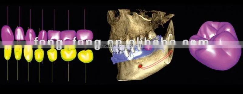 Digital 3D Intra-oral imaging X-ray machine