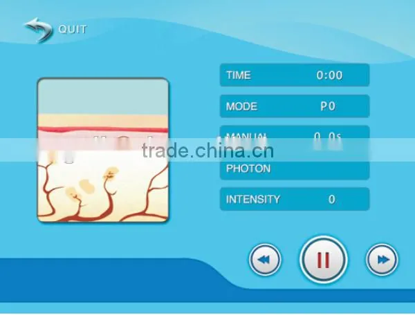 Super cold and heat hammer wrinkle removal/skin tightening thermal rf fractional machine