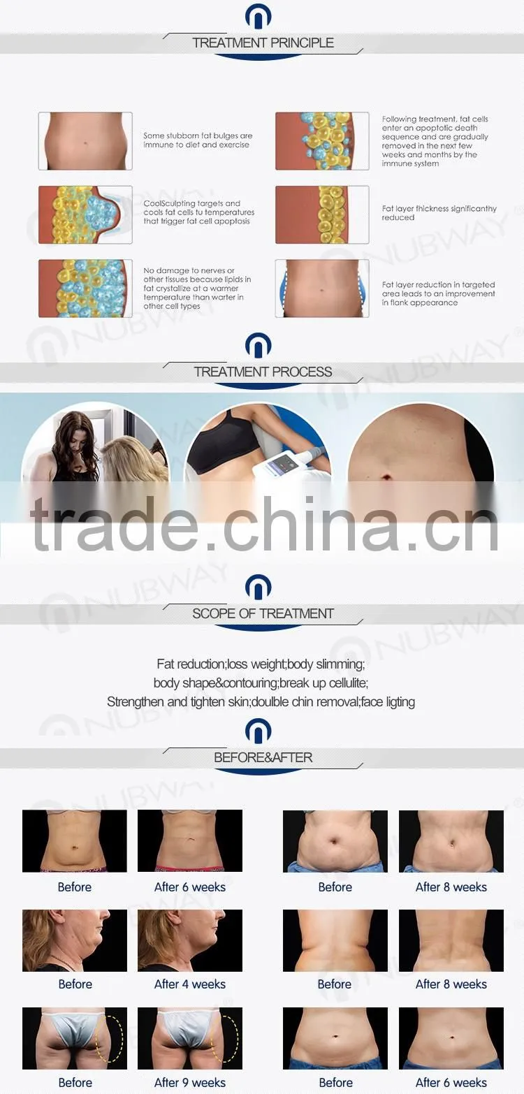 Multifunction Cavitation & RF Cryolipolysis slimming machine fat freeze body slimming cryolipolysis