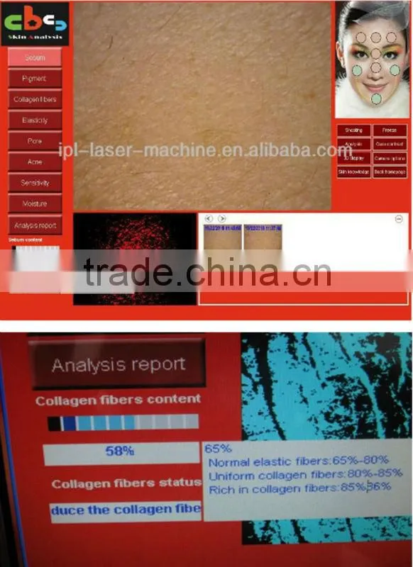 professional facial skin analysis / 3d skin analyzer
