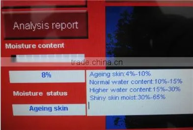 Auto-digital top CBS skin and hair analyzer