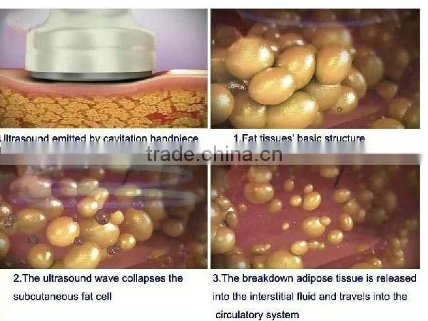 Cryolipolysis freeze fat cell slimming machine,fast fat cavitation slimming system
