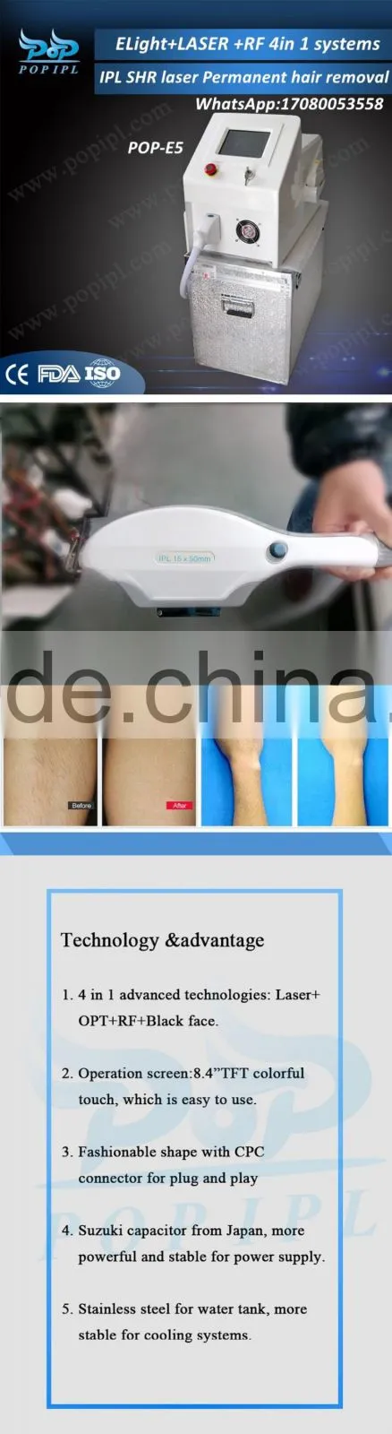ipl rf shrequipmE ipl laser-IPL SHR Permanent hair removal / Laser +E-LIGHT+RF+Black doll baby /E light IPL skin care CHINA1200W