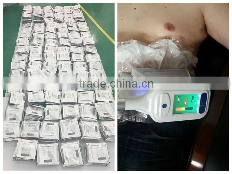 cryolipolysis weight loss machines from beauty salon equipment supplier