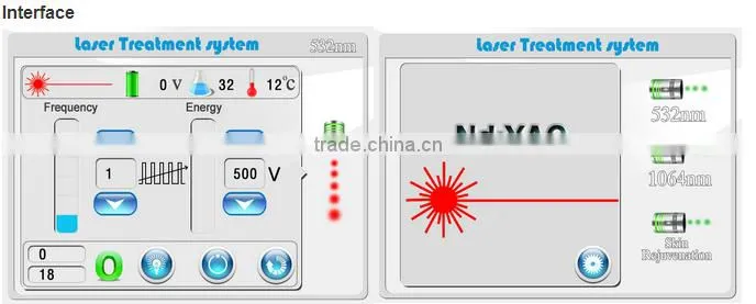 Q switched nd yag laser /tattoo removal beauty machine /laser tattoo removal with CE