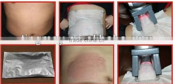 4in1 Laser Lipolysis + 40K cavitation + Body RF + Cryolipolysis Freeze Fat Machine Beauty Slimming Instruments