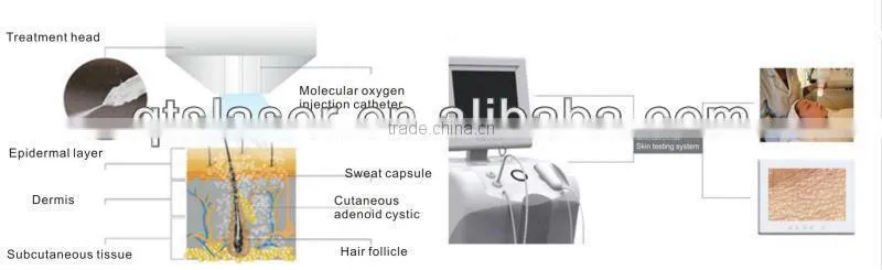 skin rejuvenation meso gun laser beauty machine meso therapy gun