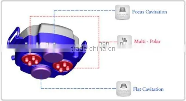2012 multifunctional Radio Frequency Fat Cavitation Slimming Equipment-CE