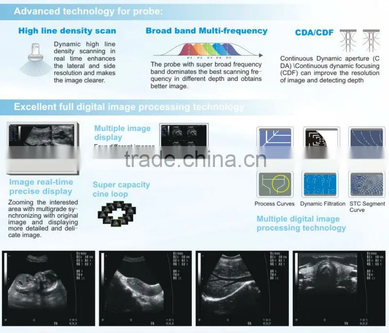 FN551 HOT selling CE approved full digital ultrasound scanner price