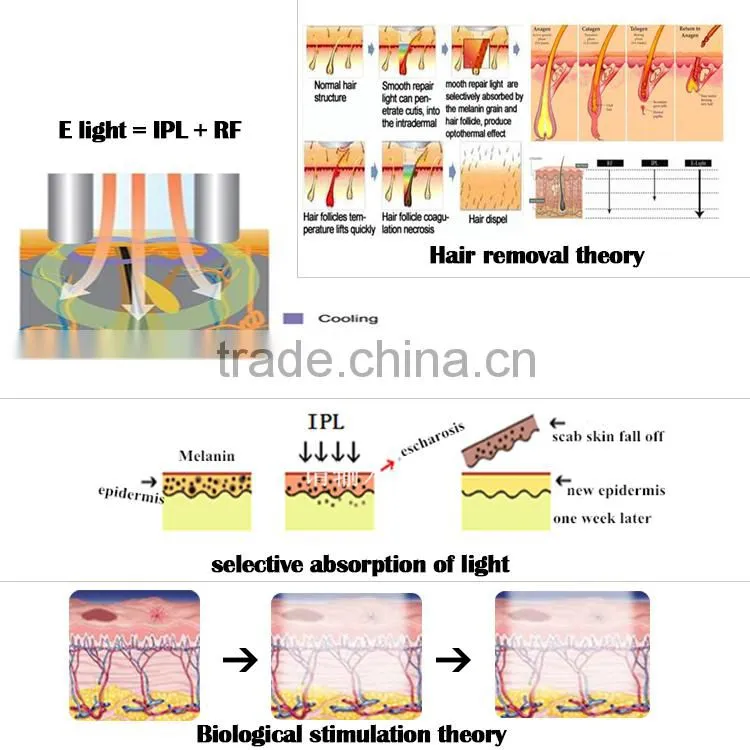 FDA technology newest most advanced painfree efficient professional IPL laser hair removal machines for sale