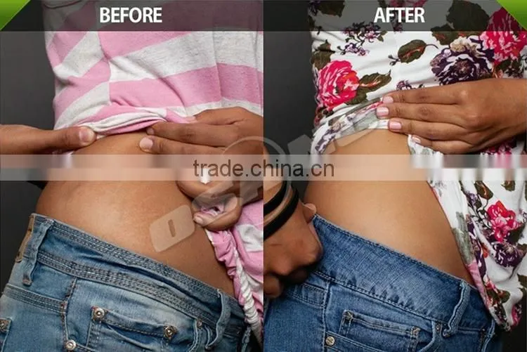 Ultrasound Fat Burning Machine/Fat Cavitation Device For Home