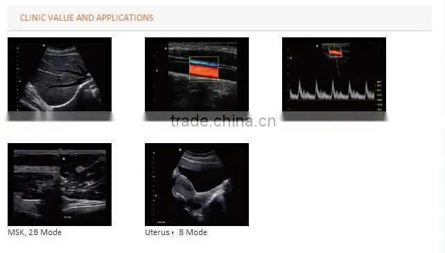 CE approved Portable Color Doppler with Optional 4D function( ECO5)