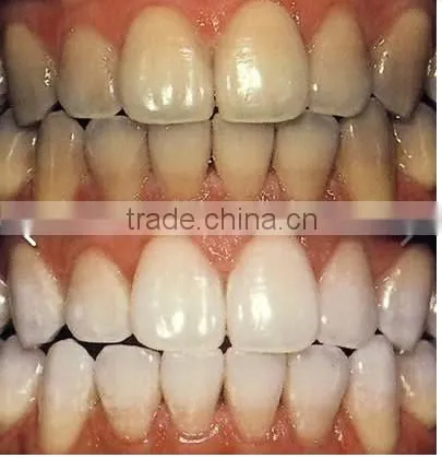 dental LED teeth whitening machine led teeth whitening