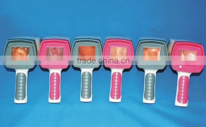 Self Exam Colposcope