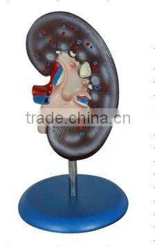 V-AM061 Best Price Medical Plastic Kidney Model