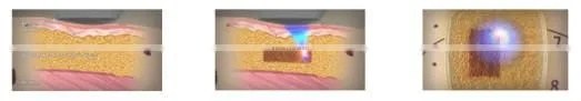 1.3cm Focal depth beauty parlour equipment