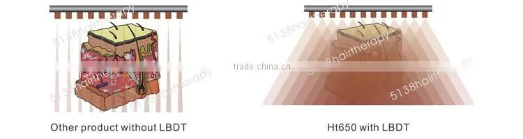 2015 Laser Led Fast Safe Hair Regrowth Beauty Salon Equipment Hair Loss Treatment Hair Regrowth Ht650
