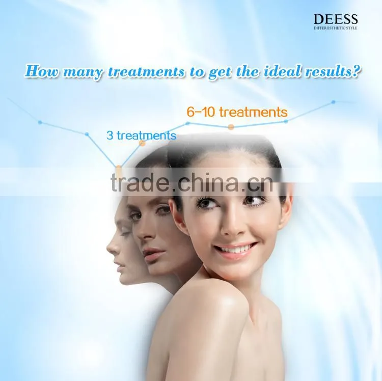 2016 Summer new ipl hair depilation device ipl depilation machine ipl laser machine